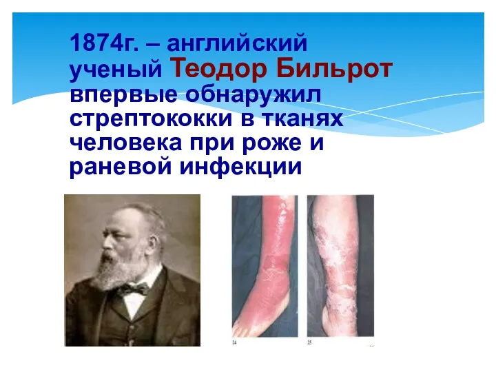 1874г. – английский ученый Теодор Бильрот впервые обнаружил стрептококки в тканях человека при