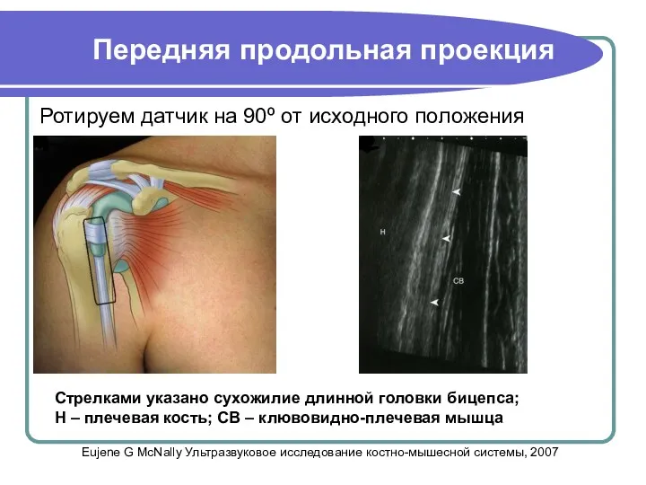 Передняя продольная проекция Ротируем датчик на 90º от исходного положения