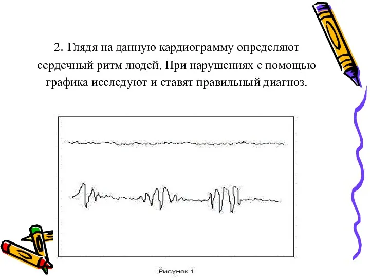 2. Глядя на данную кардиограмму определяют сердечный ритм людей. При