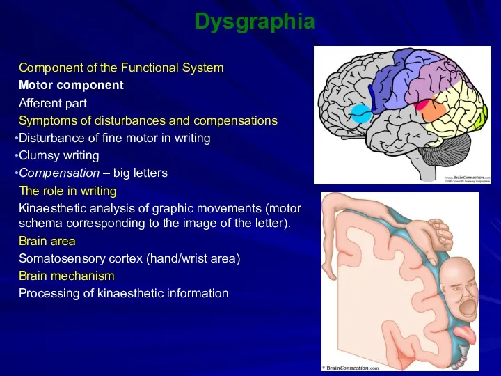 Dysgraphia Component of the Functional System Motor component Afferent part Symptoms of disturbances