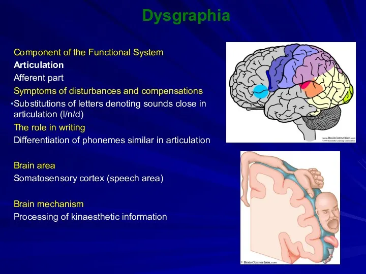 Dysgraphia Component of the Functional System Articulation Afferent part Symptoms of disturbances and