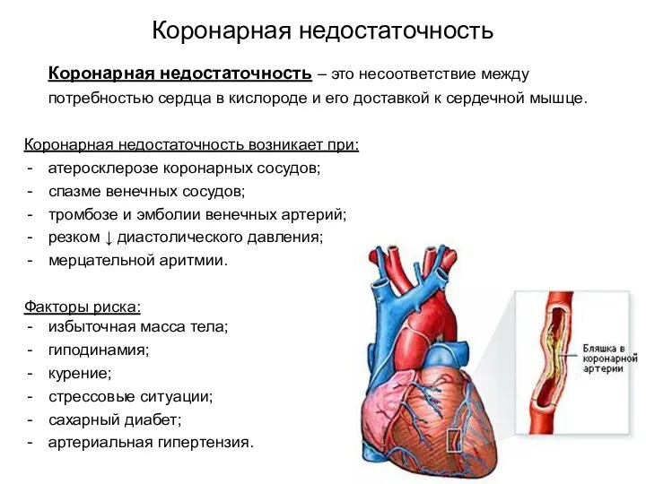 Коронарная недостаточность Коронарная недостаточность – это несоответствие между потребностью сердца