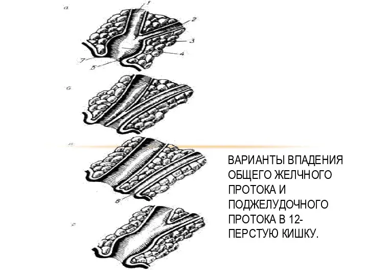 ВАРИАНТЫ ВПАДЕНИЯ ОБЩЕГО ЖЕЛЧНОГО ПРОТОКА И ПОДЖЕЛУДОЧНОГО ПРОТОКА В 12-ПЕРСТУЮ КИШКУ.