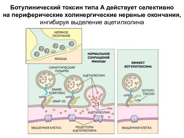 Ботулинический токсин типа А действует селективно на периферические холинергические нервные окончания, ингибируя выделение ацетилхолина