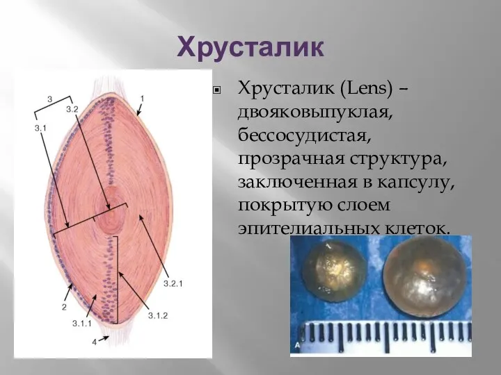 Хрусталик Хрусталик (Lens) – двояковыпуклая, бессосудистая, прозрачная структура, заключенная в капсулу, покрытую слоем эпителиальных клеток.