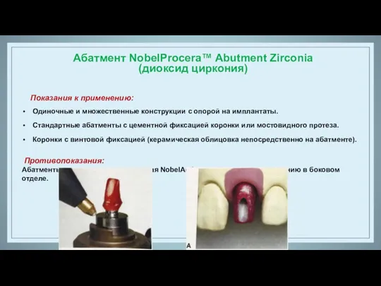 Абатмент NobelProcera™ Abutment Zirconia (диоксид циркония) Показания к применению: Одиночные