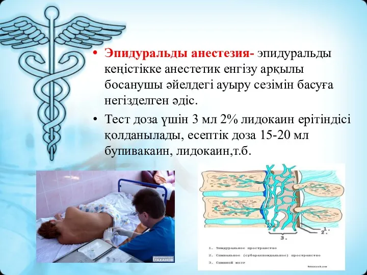 Эпидуральды анестезия- эпидуральды кеңістікке анестетик енгізу арқылы босанушы әйелдегі ауыру