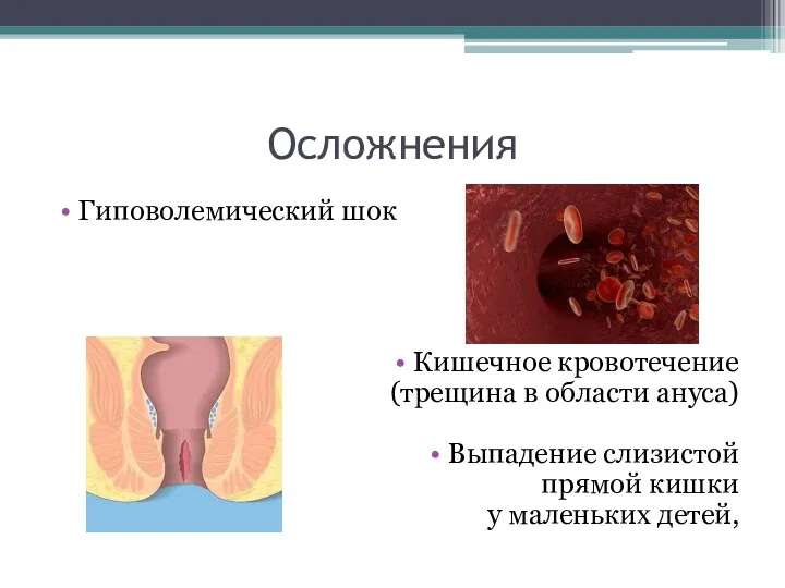 Осложнения Гиповолемический шок Кишечное кровотечение (трещина в области ануса) Выпадение слизистой прямой кишки у маленьких детей,