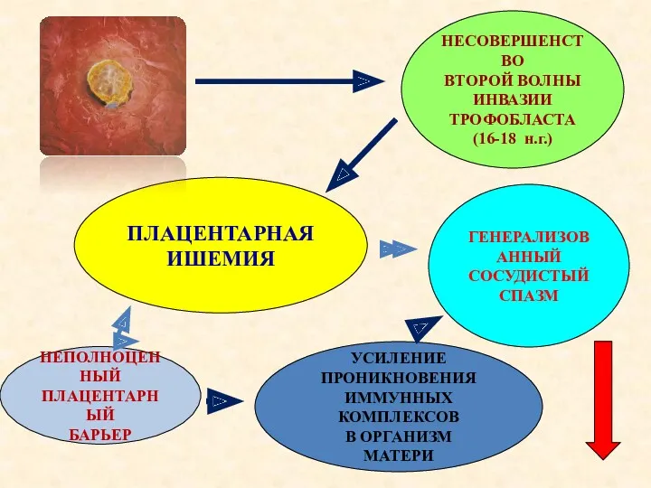 ПЛАЦЕНТАРНАЯ ИШЕМИЯ НЕСОВЕРШЕНСТВО ВТОРОЙ ВОЛНЫ ИНВАЗИИ ТРОФОБЛАСТА (16-18 н.г.) НЕПОЛНОЦЕННЫЙ