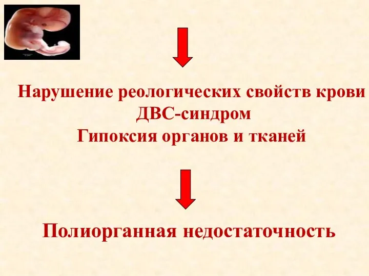 Нарушение реологических свойств крови ДВС-синдром Гипоксия органов и тканей Полиорганная недостаточность