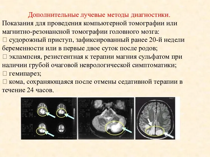 Дополнительные лучевые методы диагностики. Показания для проведения компьютерной томографии или