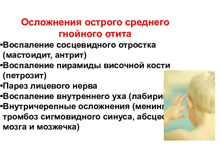 Осложнения острого среднего гнойного отита Воспаление сосцевидного отростка (мастоидит, антрит)