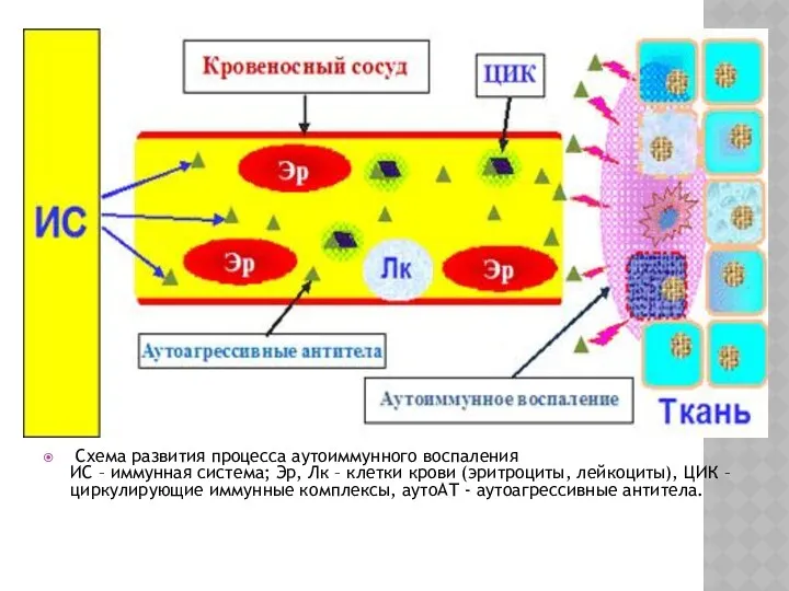 Схема развития процесса аутоиммунного воспаления ИС – иммунная система; Эр,