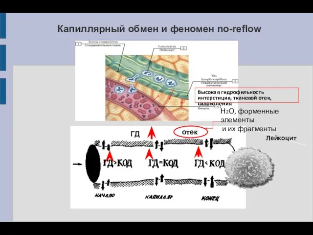 Капиллярный обмен и феномен no-reflow Лейкоцит ГД отек Высокая гидрофильность интерстиция, тканевой отек,