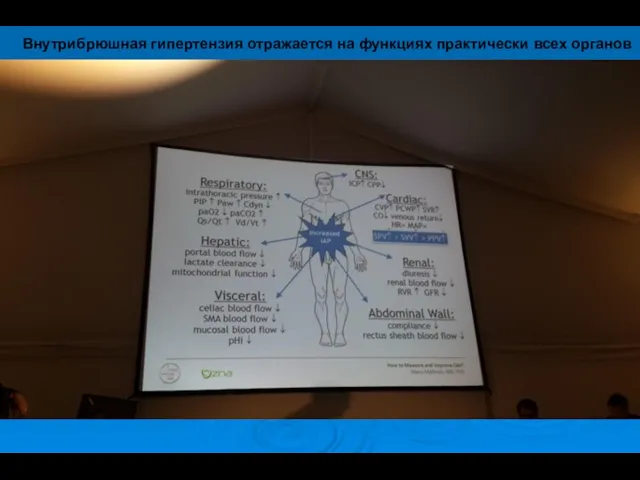 Внутрибрюшная гипертензия отражается на функциях практически всех органов