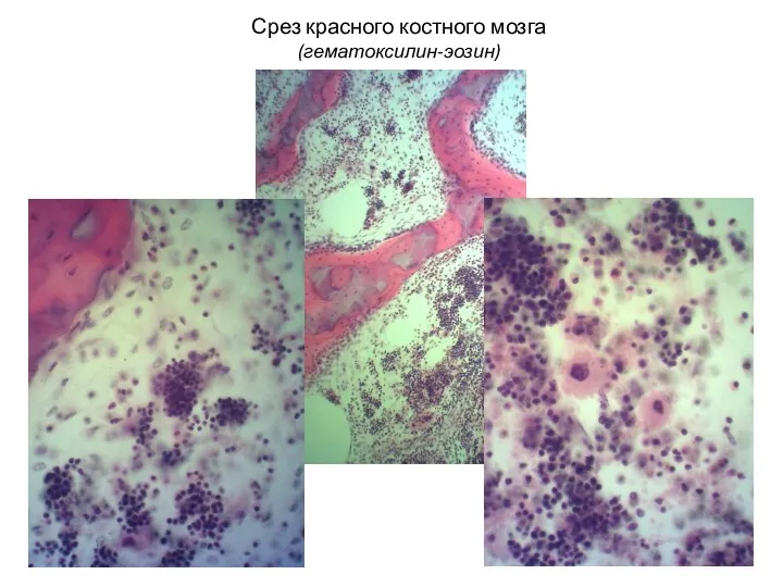 Срез красного костного мозга (гематоксилин-эозин)