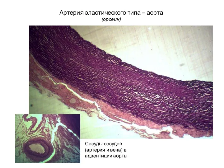 Артерия эластического типа – аорта (орсеин) Сосуды сосудов (артерия и вена) в адвентиции аорты