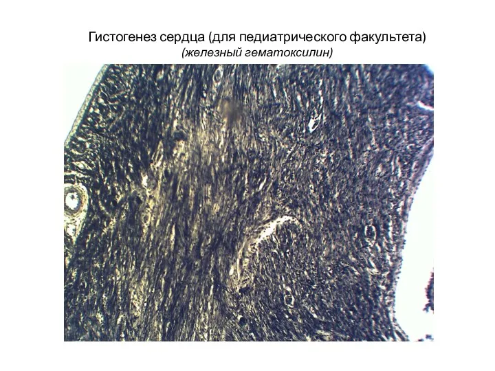 Гистогенез сердца (для педиатрического факультета) (железный гематоксилин)