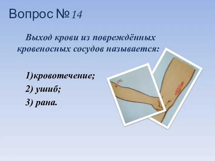 Выход крови из повреждённых кровеносных сосудов называется: 1)кровотечение; 2) ушиб; 3) рана. Вопрос №14