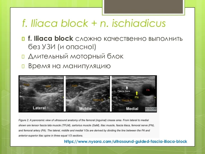 f. Iliaca block + n. ischiadicus f. Iliaca block сложно