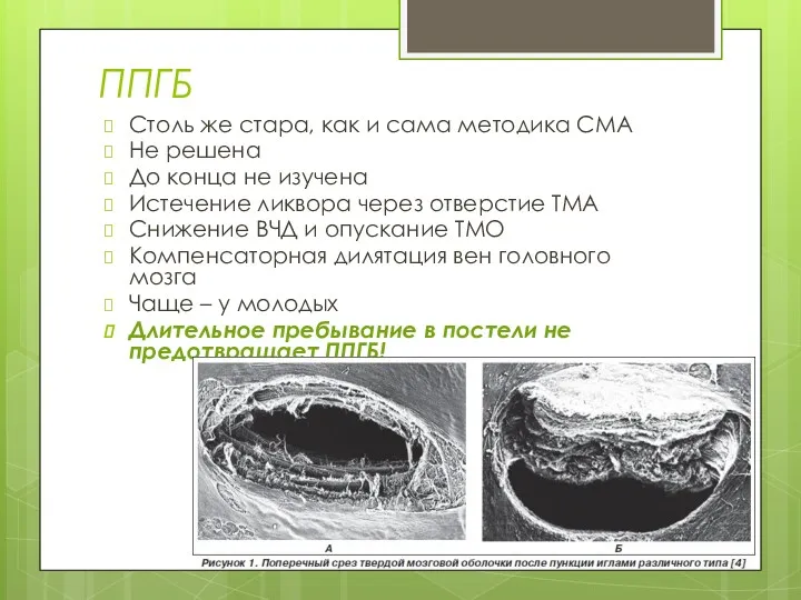 ППГБ Столь же стара, как и сама методика СМА Не