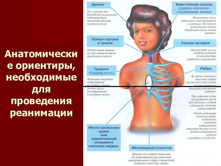 Анатомические ориентиры, необходимые для проведения реанимации