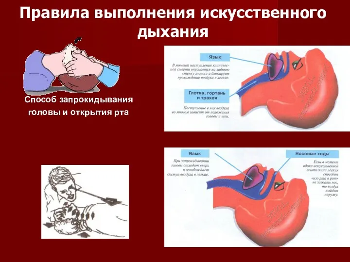 Правила выполнения искусственного дыхания Способ запрокидывания головы и открытия рта