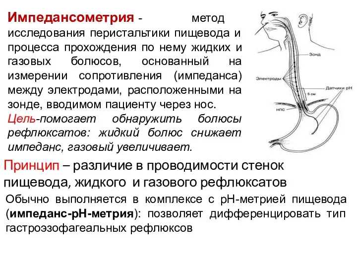 Импедансометрия - метод исследования перистальтики пищевода и процесса прохождения по