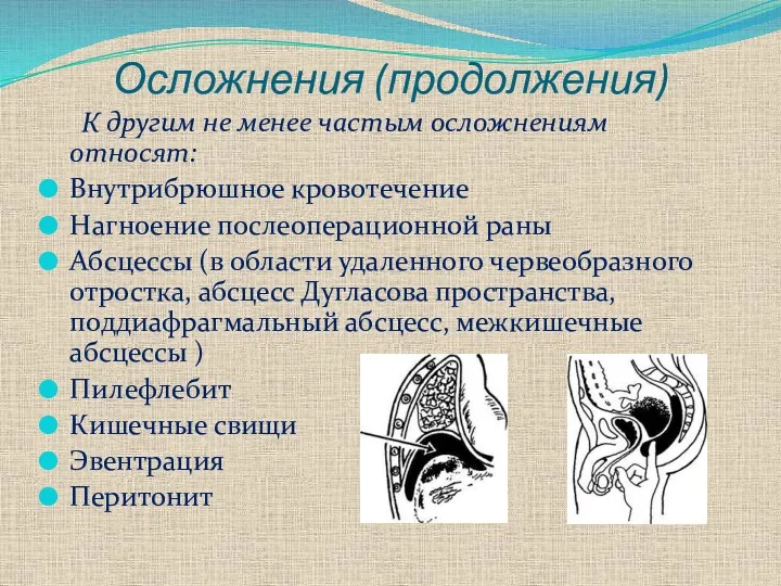 Осложнения (продолжения) К другим не менее частым осложнениям относят: Внутрибрюшное