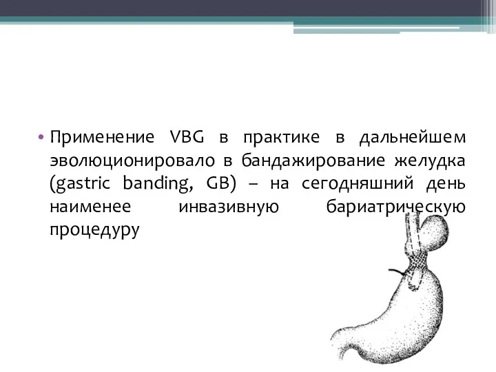 Применение VBG в практике в дальнейшем эволюционировало в бандажирование желудка