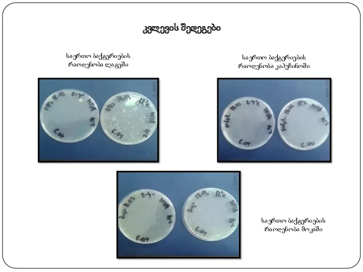 კვლევის შედეგები საერთო ბაქტერიების რაოდენობა ლატეში საერთო ბაქტერიების რაოდენობა კაპუჩინოში საერთო ბაქტერიების რაოდენობა მოკაში