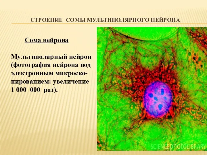 СТРОЕНИЕ СОМЫ МУЛЬТИПОЛЯРНОГО НЕЙРОНА Сома нейрона Мультиполярный нейрон (фотография нейрона