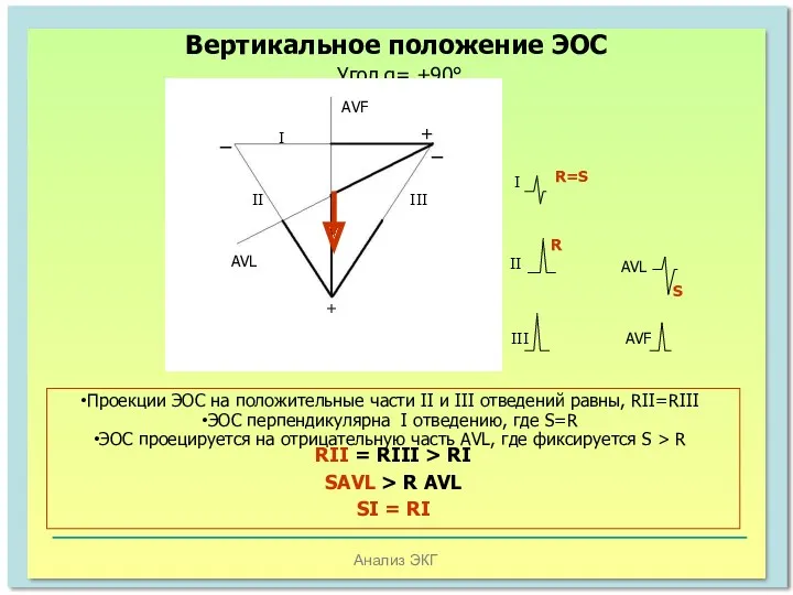 Анализ ЭКГ Вертикальное положение ЭОС Угол α= +90° Проекции ЭОС
