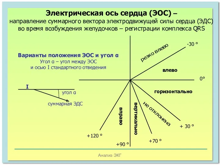 Анализ ЭКГ 0° -30 ° + 30 ° +70 °