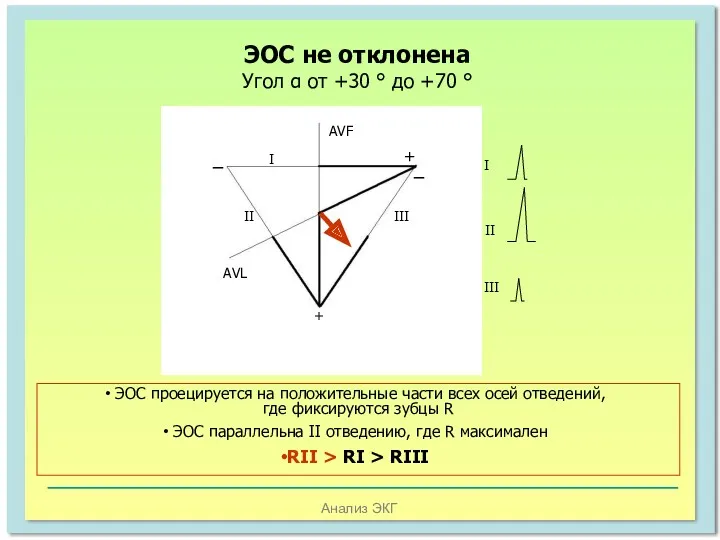 Анализ ЭКГ ЭОС не отклонена Угол α от +30 °