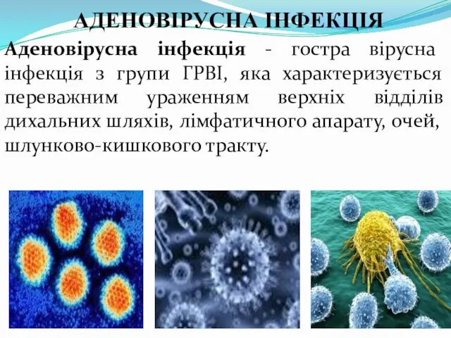 АДЕНОВІРУСНА ІНФЕКЦІЯ Аденовірусна інфекція - гостра вірусна інфекція з групи