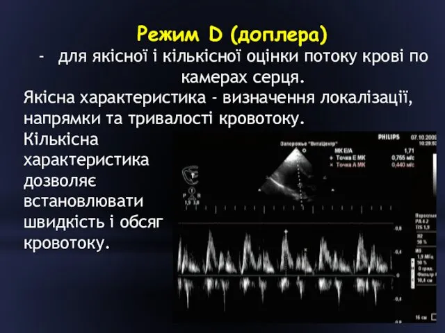 Режим D (доплера) для якісної і кількісної оцінки потоку крові