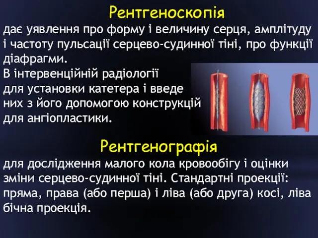 Рентгеноскопія дає уявлення про форму і величину серця, амплітуду і