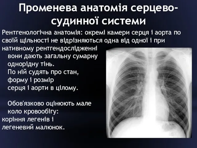 Променева анатомія серцево-судинної системи Рентгенологічна анатомія: окремі камери серця і