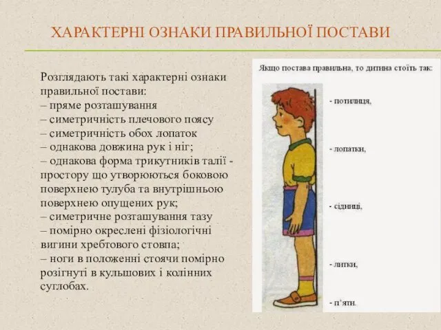 ХАРАКТЕРНІ ОЗНАКИ ПРАВИЛЬНОЇ ПОСТАВИ Розглядають такі характерні ознаки правильної постави: