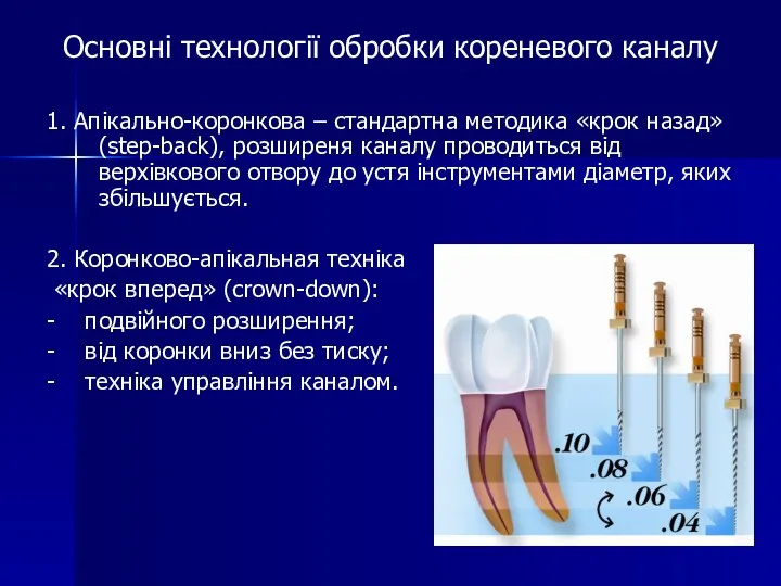 Основні технології обробки кореневого каналу 1. Апікально-коронкова – стандартна методика