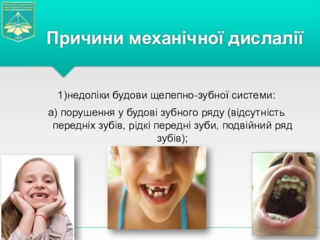 1)недоліки будови щелепно-зубної системи: а) порушення у будові зубного ряду