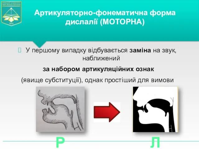 У першому випадку відбувається заміна на звук, наближений за набором