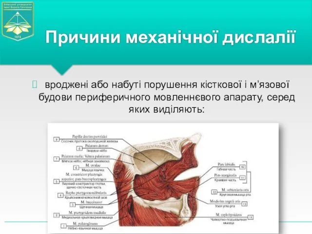 вроджені або набуті порушення кісткової і м’язової будови периферичного мовленнєвого