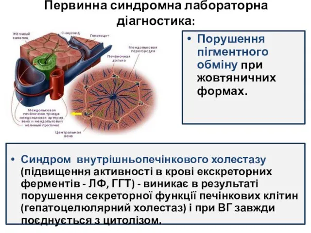 Первинна синдромна лабораторна діагностика: Синдром внутрішньопечінкового холестазу (підвищення активності в