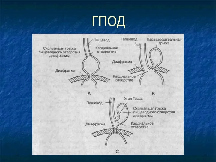 ГПОД