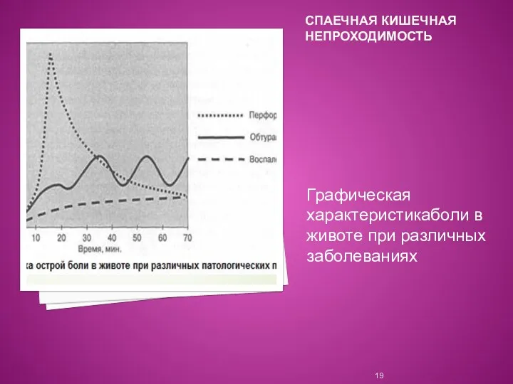 СПАЕЧНАЯ КИШЕЧНАЯ НЕПРОХОДИМОСТЬ Графическая характеристикаболи в животе при различных заболеваниях