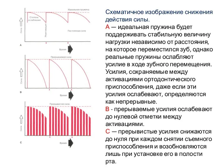 Схематичное изображение снижения действия силы. А — идеальная пружина будет