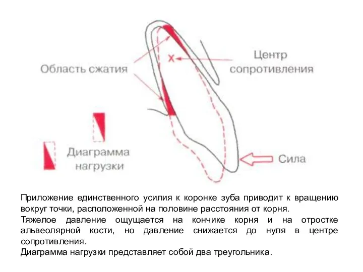 Приложение единственного усилия к коронке зуба приводит к вращению вокруг