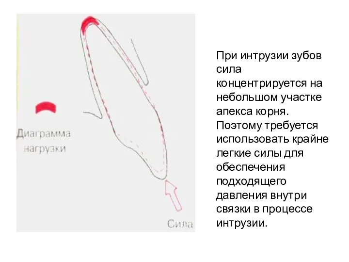 При интрузии зубов сила концентрируется на небольшом участке апекса корня.